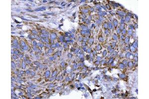 IHC analysis of EIF3A using anti-EIF3A antibody (ABIN7599942). (EIF3A 抗体  (AA 13-477))