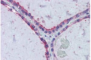 Immunohistochemistry (Formalin-fixed Paraffin-embedded Sections) (IHC (fp)) image for anti-Kinesin Family Member 20A (KIF20A) (C-Term) antibody (ABIN6744463)