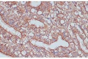Immunohistochemistry of paraffin-embedded Rat ovary using MOB4 Polyclonal Antibody at dilution of 1:100 (40x lens). (MOBKL3 抗体)