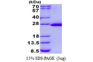 Image no. 1 for FtsJ RNA Methyltransferase Homolog 2 (FTSJ2) (AA 51-246) protein (His tag) (ABIN1098388)