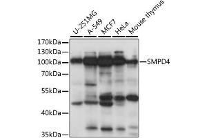 Western blot analysis of extracts of various cell lines, using SMPD4 antibody (ABIN6291650) at 1:1000 dilution. (SMPD4 抗体)