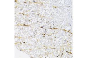 Immunohistochemistry of paraffin-embedded rat spinal cord using KIF1B Antibody (ABIN2563552) at dilution of 1:100 (40x lens). (KIF1B 抗体)