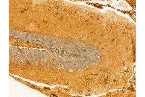 ABIN6265901 and ABIN6273084 at 1/100 staining Mouse brain tissue by IHC-P. (UQCRFS1 抗体  (C-Term))