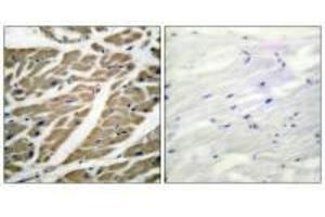 Immunohistochemical analysis of paraffin-embedded human heart tissue using Sodium Channel-pan antibody. (SCN5A 抗体)
