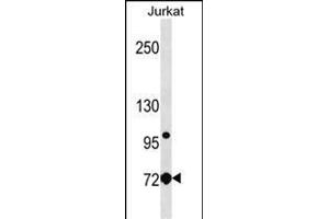LCP1 Antibody (Center) (ABIN1538283 and ABIN2850258) western blot analysis in Jurkat cell line lysates (35 μg/lane). (LCP1 抗体  (AA 306-335))