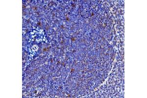 IHC analysis of IL-21/Il21 using anti-IL-21/Il21 antibody (ABIN7600316).