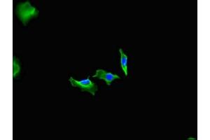 Immunofluorescent analysis of Hela cells using ABIN7152932 at dilution of 1:100 and Alexa Fluor 488-congugated AffiniPure Goat Anti-Rabbit IgG(H+L) (Fidgetin 抗体  (AA 132-371))