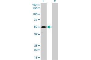 Western Blotting (WB) image for anti-Acid Phosphatase 2, Lysosomal (ACP2) (AA 1-423) antibody (ABIN559751)