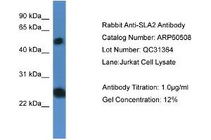 WB Suggested Anti-SLA2  Antibody Titration: 0. (SLAP2 抗体  (N-Term))