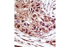 Image no. 1 for anti-Ubiquitin Specific Peptidase 14 (USP14) (N-Term) antibody (ABIN357546) (USP14 抗体  (N-Term))