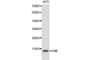 Western blot analysis of A375 cell lysate using S100B antibody. (S100B 抗体  (AA 1-92))