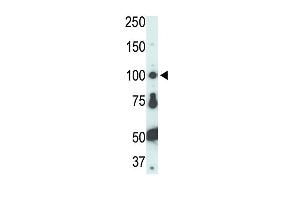 Western Blotting (WB) image for anti-General Transcription Factor IIE, Polypeptide 1, alpha 56kDa (GTF2E1) (AA 782-811), (C-Term) antibody (ABIN5538734)