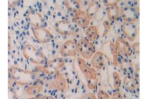 Detection of IL11Ra in Mouse Kidney Tissue using Polyclonal Antibody to Interleukin 11 Receptor Alpha (IL11Ra)