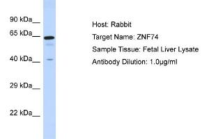 Host: Rabbit Target Name: ZNF74 Sample Tissue: Human Fetal Liver Antibody Dilution: 1ug/ml (ZNF74 抗体  (N-Term))