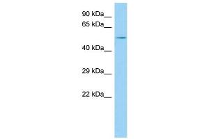 Host: Rabbit Target Name: GPRIN2 Sample Type: MDA-MB-435S Whole Cell lysates Antibody Dilution: 1.