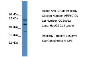 WB Suggested Anti-ICAM1  Antibody Titration: 0. (ICAM1 抗体  (N-Term))