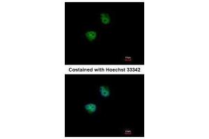 ICC/IF Image Immunofluorescence analysis of paraformaldehyde-fixed HeLa, using S6K2, antibody at 1:500 dilution. (RPS6KB2 抗体  (Center))