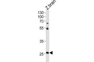 Western Blotting (WB) image for anti-Homeobox C4 (HOXC4) antibody (ABIN3004626) (HOXC4 抗体)