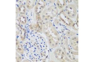 Immunohistochemistry of paraffin-embedded rat kidney using UBE3A antibody. (ube3a 抗体  (AA 300-590))