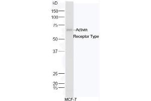 Human MCF-7 cell lysates probed with Rabbit Anti-ACVR2B/ACTR-IIB Polyclonal Antibody, Unconjugated  at 1:5000 for 90 min at 37˚C. (ACVR2B 抗体  (AA 45-150))