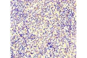 Immunohistochemistry of paraffin-embedded human spleen tissue using ABIN7150361 at dilution of 1:100 (IKZF1 抗体  (AA 1-265))