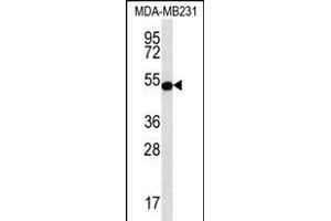 ST Antibody (Center) (ABIN656667 and ABIN2845907) western blot analysis in MDA-M cell line lysates (35 μg/lane). (STAP2 抗体  (AA 187-216))