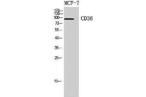 Western Blotting (WB) image for anti-CD36 (CD36) (Internal Region) antibody (ABIN3178931) (CD36 抗体  (Internal Region))