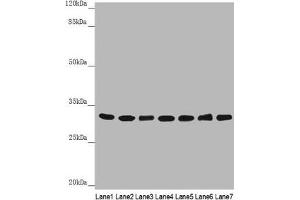 Western blot All lanes: HCCS antibody at 3. (HCCS 抗体  (AA 1-268))