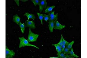 anti-Guanine Nucleotide Binding Protein (G Protein), alpha Transducing Activity Polypeptide 1 (GNAT1) (AA 92-170) antibody