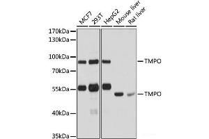 Western blot analysis of extracts of various cell lines using TMPO Polyclonal Antibody at dilution of 1:1000. (Thymopoietin 抗体)