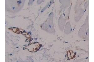 Immunohistochemistry (IHC) image for anti-alpha-Fetoprotein (AFP) (AA 409-611) antibody (ABIN7429544)