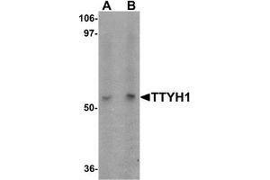 Western blot analysis of TTYH1 in Raji cell lysate with TTYH1 antibody at (A) 1 and (B) 2 ug/mL. (TTYH1 抗体  (C-Term))
