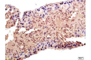 Formalin-fixed and paraffin embedded rat testis labeled with Anti-PAPOG Polyclonal Antibody, Unconjugated (ABIN1714858) at 1:200 followed by conjugation to the secondary antibody and DAB staining. (PAPOLG 抗体  (AA 101-200))