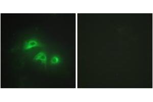 Immunofluorescence analysis of HepG2 cells, using KAD1 Antibody . (Adenylate Kinase 1 抗体  (AA 101-150))