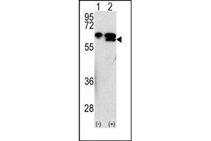 Image no. 1 for anti-Matrix Metallopeptidase 3 (Stromelysin 1, Progelatinase) (MMP3) (Middle Region) antibody (ABIN358700) (MMP3 抗体  (Middle Region))