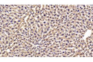 Immunohistochemistry (IHC) image for anti-Macrophage Migration Inhibitory Factor (Glycosylation-Inhibiting Factor) (MIF) (AA 3-111) antibody (ABIN7432415)