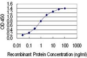 Detection limit for recombinant GST tagged IRX1 is 0. (IRX1 抗体  (AA 424-479))