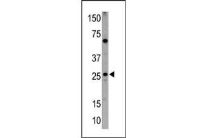 Western blot analysis of anti-NIP1 BH3 Domain Pab (ABIN388133 and ABIN2846370) in HL60 cell lysates (35 μg/lane). (BNIP1 抗体  (AA 92-127))