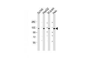 Lane 1: Du145, Lane 2: HepG2, Lane 3: mouse brain, Lane 4: Hela cell lysate at 20 µg per lane, probed with bsm-51347M DAB2IP (1626CT702. (DAB2IP 抗体)