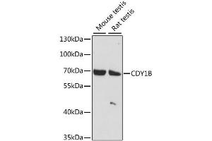 Western blot analysis of extracts of various cell lines, using CDY1B antibody (ABIN6293284) at 1:1000 dilution. (CDY1 抗体)