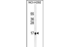 HEPN1 Antibody (N-term) (ABIN654808 and ABIN2844482) western blot analysis in NCI- cell line lysates (35 μg/lane). (HEPN1 抗体  (N-Term))