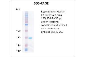 SDS-PAGE (SDS) image for Interleukin 11 (IL11) (Active) protein (ABIN5509338) (IL-11 蛋白)