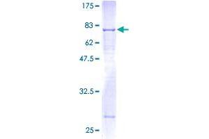 BMP10 Protein (AA 1-424) (GST tag)