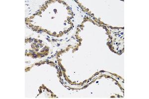 Immunohistochemistry of paraffin-embedded human prostate using CALCB antibody at dilution of 1:100 (40x lens).