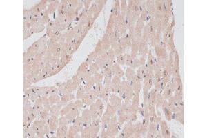 Immunohistochemistry of paraffin-embedded Rat heart using PRPF31 Polyclonal Antibody at dilution of 1:100 (40x lens). (PRPF31 抗体)