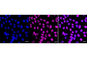 Immunocytochemical staining of HepG2 cells with DGCR8 antibody (ABIN7798333), 1:1,000). (Recombinant DGCR8 抗体)
