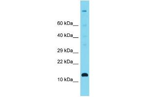 Host: Rabbit Target Name: C12orf23 Sample Type: Fetal Heart lysates Antibody Dilution: 1. (C12ORF23 抗体  (C-Term))