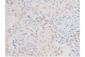 Immunohistochemistry (IHC) image for anti-Forkhead Box O4 (FOXO4) (pSer197) antibody (ABIN6255069)