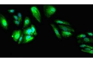 Immunofluorescent analysis of HepG2 cells using ABIN7149738 at dilution of 1:100 and Alexa Fluor 488-congugated AffiniPure Goat Anti-Rabbit IgG(H+L) (DEPDC1B 抗体  (AA 343-529))