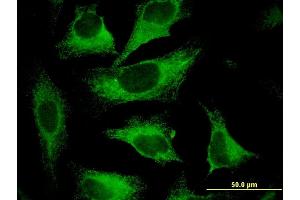 Immunofluorescence of monoclonal antibody to CAST on HeLa cell. (Calpastatin 抗体  (AA 582-669))